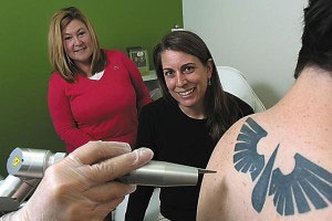 Laser tattoo removal being performed on a back tattoo